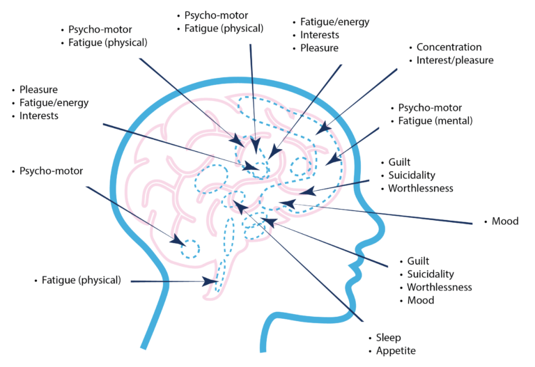brain-diagram-2-768×527